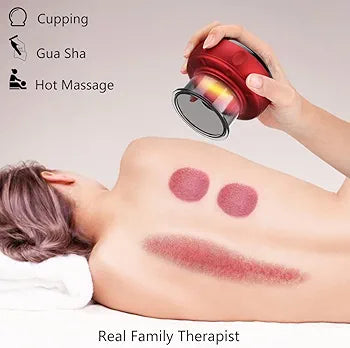 Rechargeable Hajama Cupping Massage Anti Cellulite Magnet Therapy, Wireless Guasha Scraping Fat Burner Slimming Body Scraping Cupping