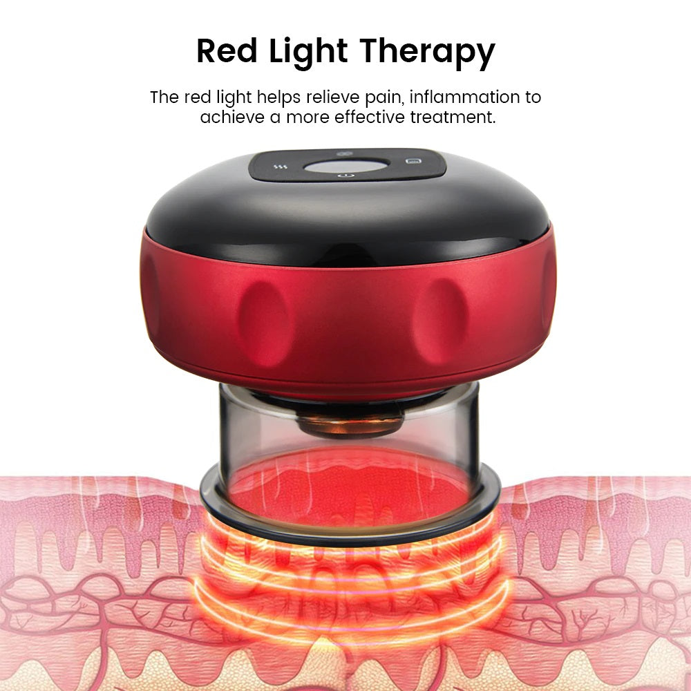 Rechargeable Hajama Cupping Massage Anti Cellulite Magnet Therapy, Wireless Guasha Scraping Fat Burner Slimming Body Scraping Cupping