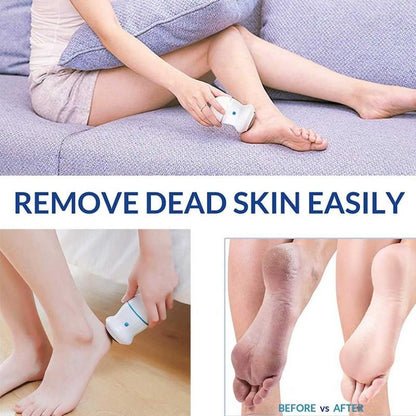 Find Back Callus Remover with Built in vacuum Electric Foot Grinder