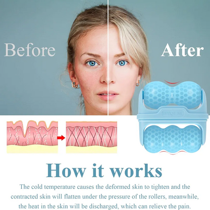 2 in 1 Ice Roller Facial Massager