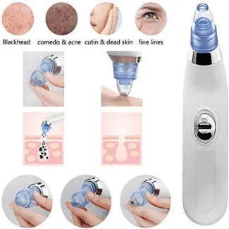 Derma Suction Blackhead Remover